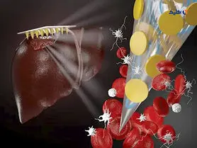 محقق ایرانی وصله نوینی برای جلوگیری از خونریزی زخم ابداع کرد