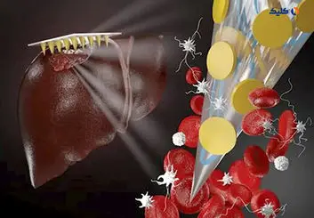 محقق ایرانی وصله نوینی برای جلوگیری از خونریزی زخم ابداع کرد