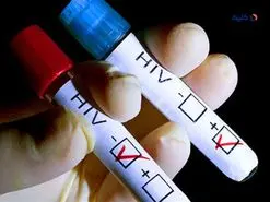 یک بیمار مبتلا به HIV با پیوند سلول‌های بنیادی درمان شد