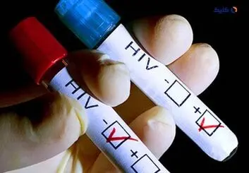 یک بیمار مبتلا به HIV با پیوند سلول‌های بنیادی درمان شد