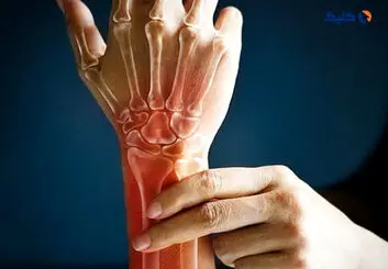 کمک به رشد استخوان ها با روشی جدید