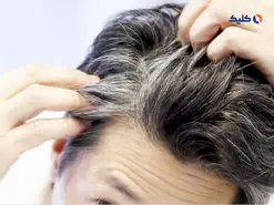 دانشمندان علت خاکستری‌شدن موها را کشف کردند