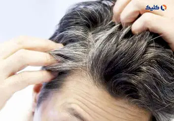 دانشمندان علت خاکستری‌شدن موها را کشف کردند
