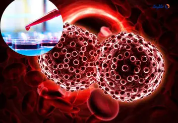 تشخیص زودهنگام سرطان با یک تکه کاغذ