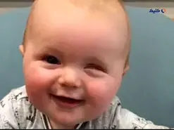 جلوگیری از نابینایی دوران کودکی با کمک یک مدل هوش مصنوعی