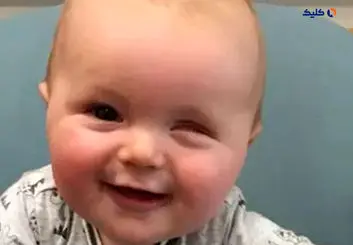 جلوگیری از نابینایی دوران کودکی با کمک یک مدل هوش مصنوعی