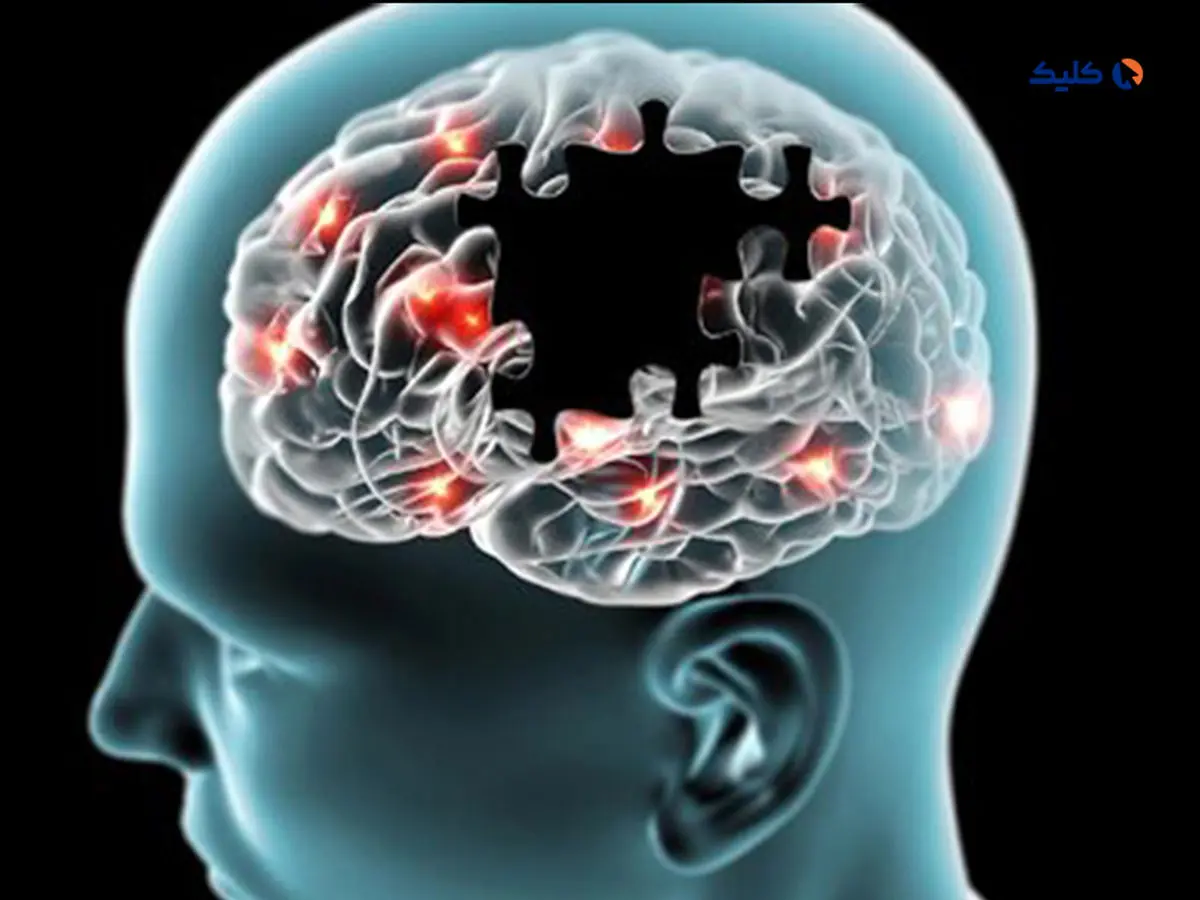 یک فرآیند طبیعی که از آلزایمر پیشگیری می‌کند