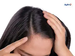 کمبود پتاسیم یکی از دلایل عمده ریزش مو