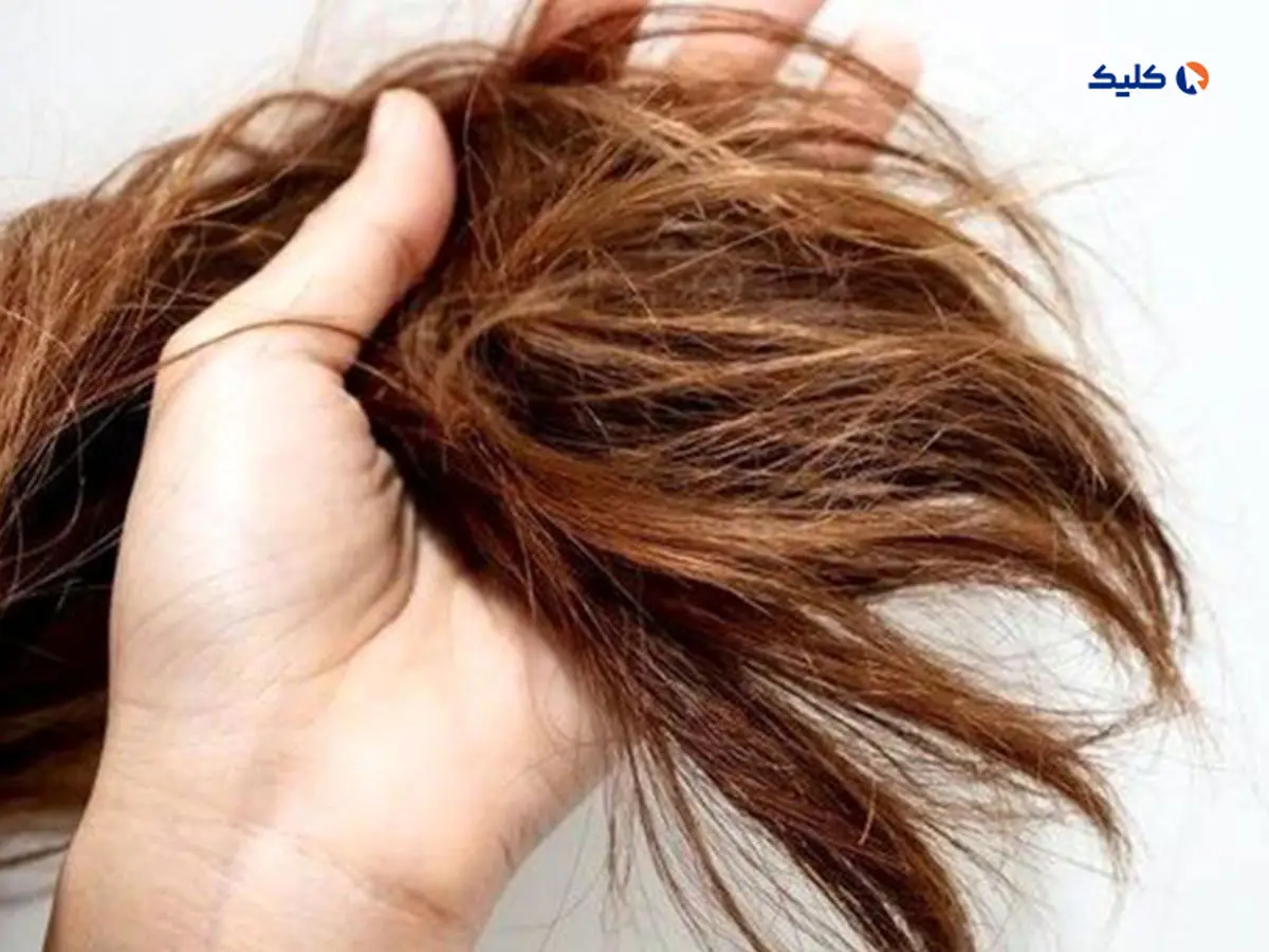 با آزمایش مو می‌توان ریسک بروز بیماری‌های قلبی‌عروقی را مشخص کرد