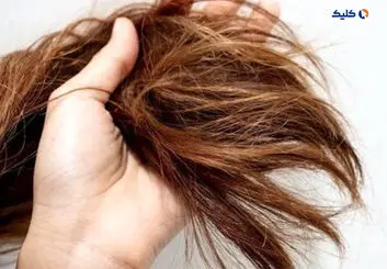 با آزمایش مو می‌توان ریسک بروز بیماری‌های قلبی‌عروقی را مشخص کرد