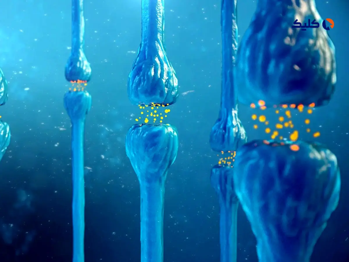 اسکیزوفرنی ممکن است با کمبود ویتامین D مادر در بارداری ارتباط داشته باشد