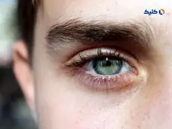 محققان موفق به توسعه دارویی شد‌ه‌‌اند که از ضعف بینایی در بیماران دیابتی جلوگیری می‌کند