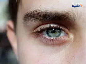 محققان موفق به توسعه دارویی شد‌ه‌‌اند که از ضعف بینایی در بیماران دیابتی جلوگیری می‌کند