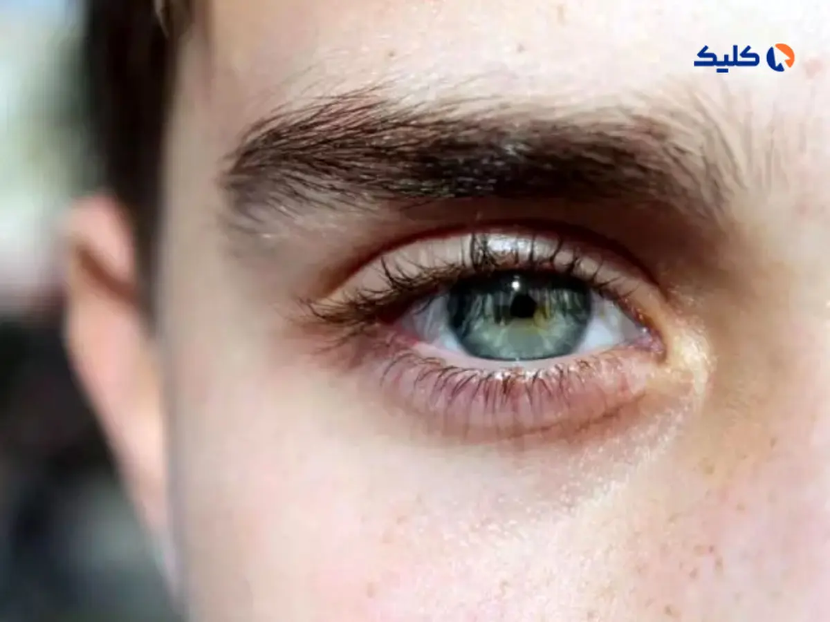 محققان موفق به توسعه دارویی شد‌ه‌‌اند که از ضعف بینایی در بیماران دیابتی جلوگیری می‌کند