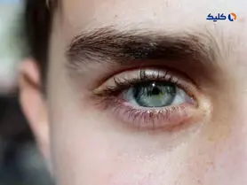 محققان موفق به توسعه دارویی شد‌ه‌‌اند که از ضعف بینایی در بیماران دیابتی جلوگیری می‌کند