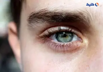 محققان موفق به توسعه دارویی شد‌ه‌‌اند که از ضعف بینایی در بیماران دیابتی جلوگیری می‌کند