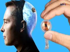 اولین آزمایش انسانی تراشه مغزی نورالینک احتمالاً امسال انجام می‌شود