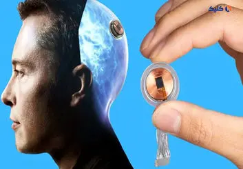 اولین آزمایش انسانی تراشه مغزی نورالینک احتمالاً امسال انجام می‌شود