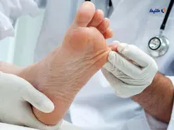 بهبود زخم های دیابت با طراحی و ساخت زخم پوش های پودری