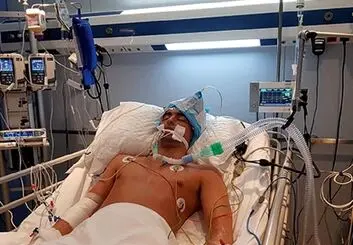 دانشمندان الگوی پنهان آگاهی را در مغز بیماران به کما رفته، شناسایی کردند