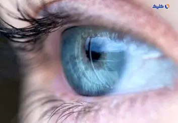 دانشمندان موفق به احیای بینایی بیماران با استفاده از سلول‌های بنیادی شدند