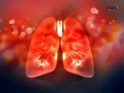 عامل التهاب ریه به وسیله سلول های ایمنی این عضو از بین می روند