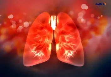 عامل التهاب ریه به وسیله سلول های ایمنی این عضو از بین می روند