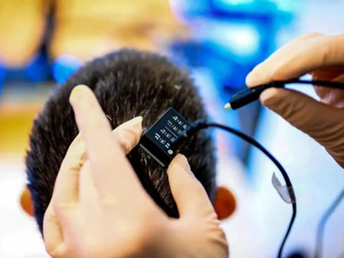 ایمپلنت مغزی با هوش مصنوعی قابلیت تکلم را با سرعتی بالاتر از همیشه به بیماران فلج برگرداند