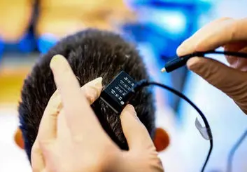 ایمپلنت مغزی با هوش مصنوعی قابلیت تکلم را با سرعتی بالاتر از همیشه به بیماران فلج برگرداند