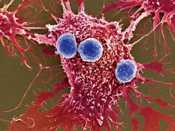 تبدیل سلول‌های سرطانی مهاجم به سلول‌های سالم