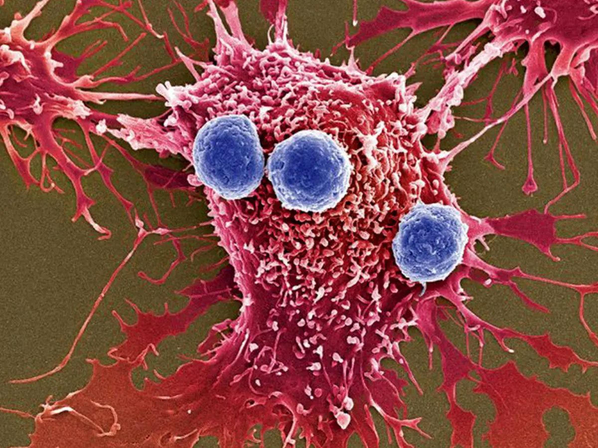 تبدیل سلول‌های سرطانی مهاجم به سلول‌های سالم