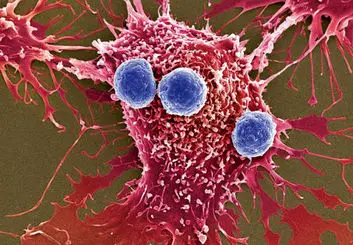 تبدیل سلول‌های سرطانی مهاجم به سلول‌های سالم