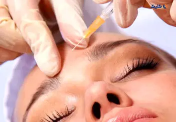 ارتباط بین بوتاکس و درمان افسردگی و اضطراب