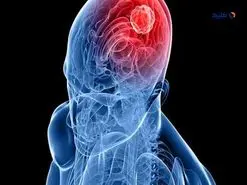 توسعه ابزار کوچکی که می‌تواند هم‌زمان بیش از ۲۰ درمان را برای سرطان مغز تست کند