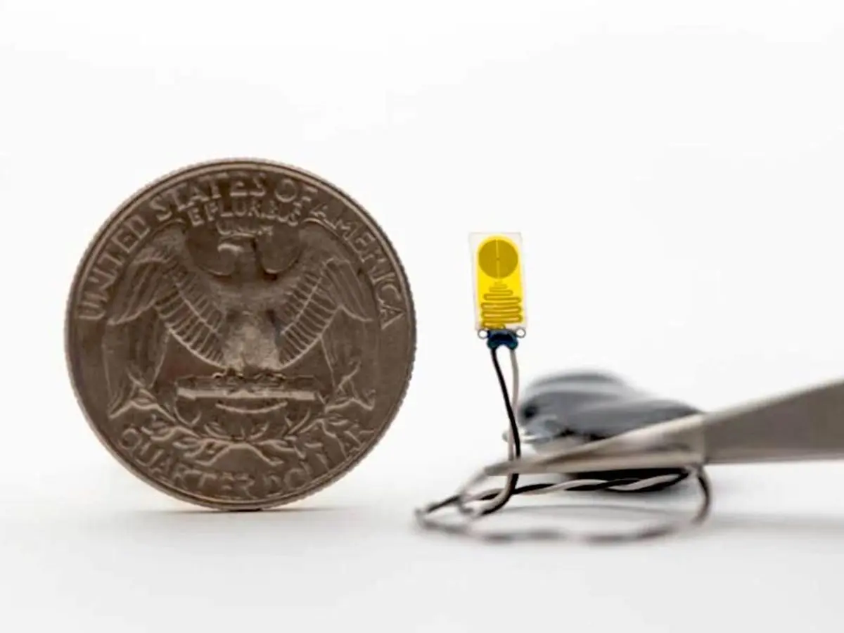 ساخت ایمپلنت بسیار کوچکی که می‌تواند سلامت عضو پیوندی را تحت نظر بگیرد