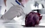 قلب مصنوعی به کمک بیماران می آید