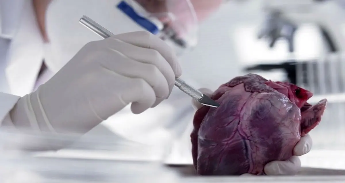 قلب مصنوعی به کمک بیماران می آید