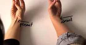 نشانه های تکامل که هنوز در بدن ما پیدا است