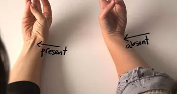 نشانه های تکامل که هنوز در بدن ما پیدا است