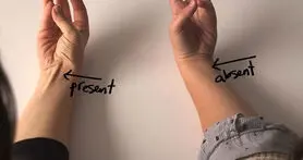 نشانه های تکامل که هنوز در بدن ما پیدا است