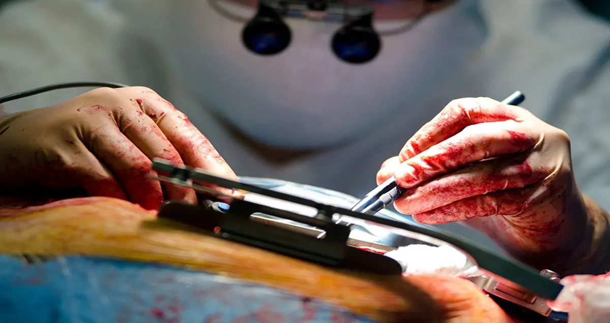 پیوند قلب خوک به انسان در آینده نزدیک