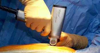 جراحی قلب بدون متوقف کردن آن میسر شد