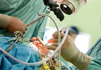 امکان جراحی مغز با کمک هوش مصنوعی طی ۲ سال آینده
