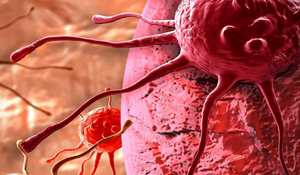 رمزگشایی از زبان پنهان سرطان
