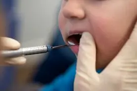 آیا با عصب کشی دندان شیری  عصب دندان دائمی جایگزین آسیب می بیند؟