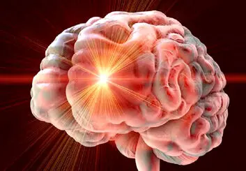 بهبود تحرک و تعادل ۱۲ سال پس از سکته مغزی با تحریک مغناطیسی
