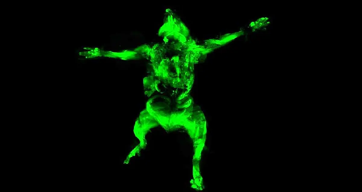 رقیب اشعه X قادر به نمایش شبکه عصبی بدن است