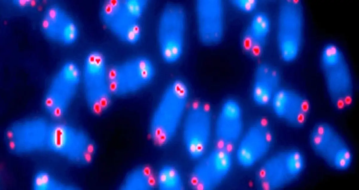 کشف هورمن افزایش طول عمر سلول های انسانی