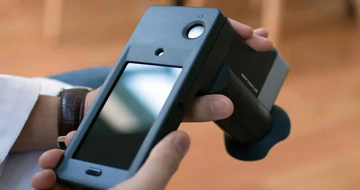 تست بینایی سنجی توسط گوشی هوشمند کاربران