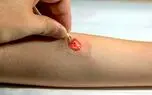 کمک تاتو الکترونیکی به سلامت افراد